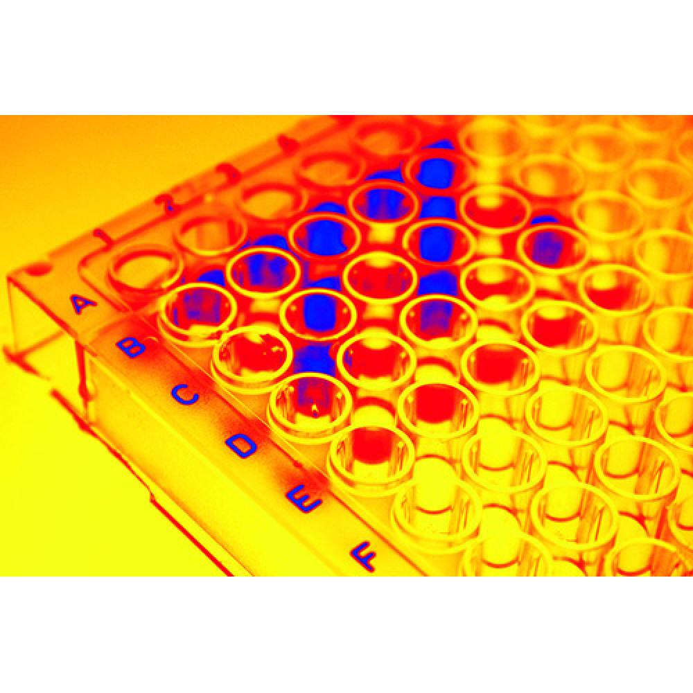 Protein Binding Plates at Kelley Bishop blog